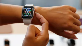 Apple Watch eşleştirilmesi nasıl kaldırılır?